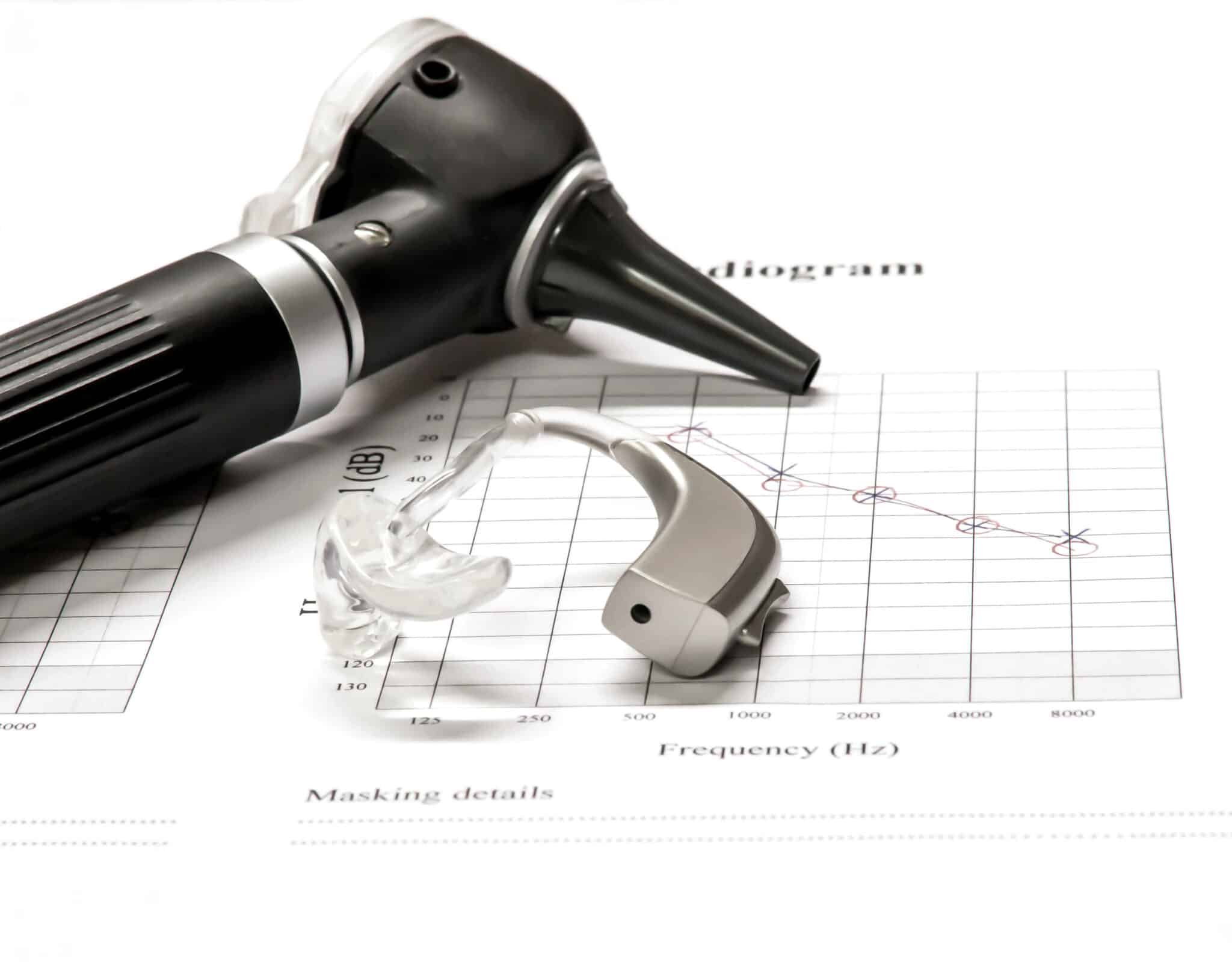 Otoscope and Hearing Aid with test results Otoscope and behind the ear hearing aid being displayed on an audiogram